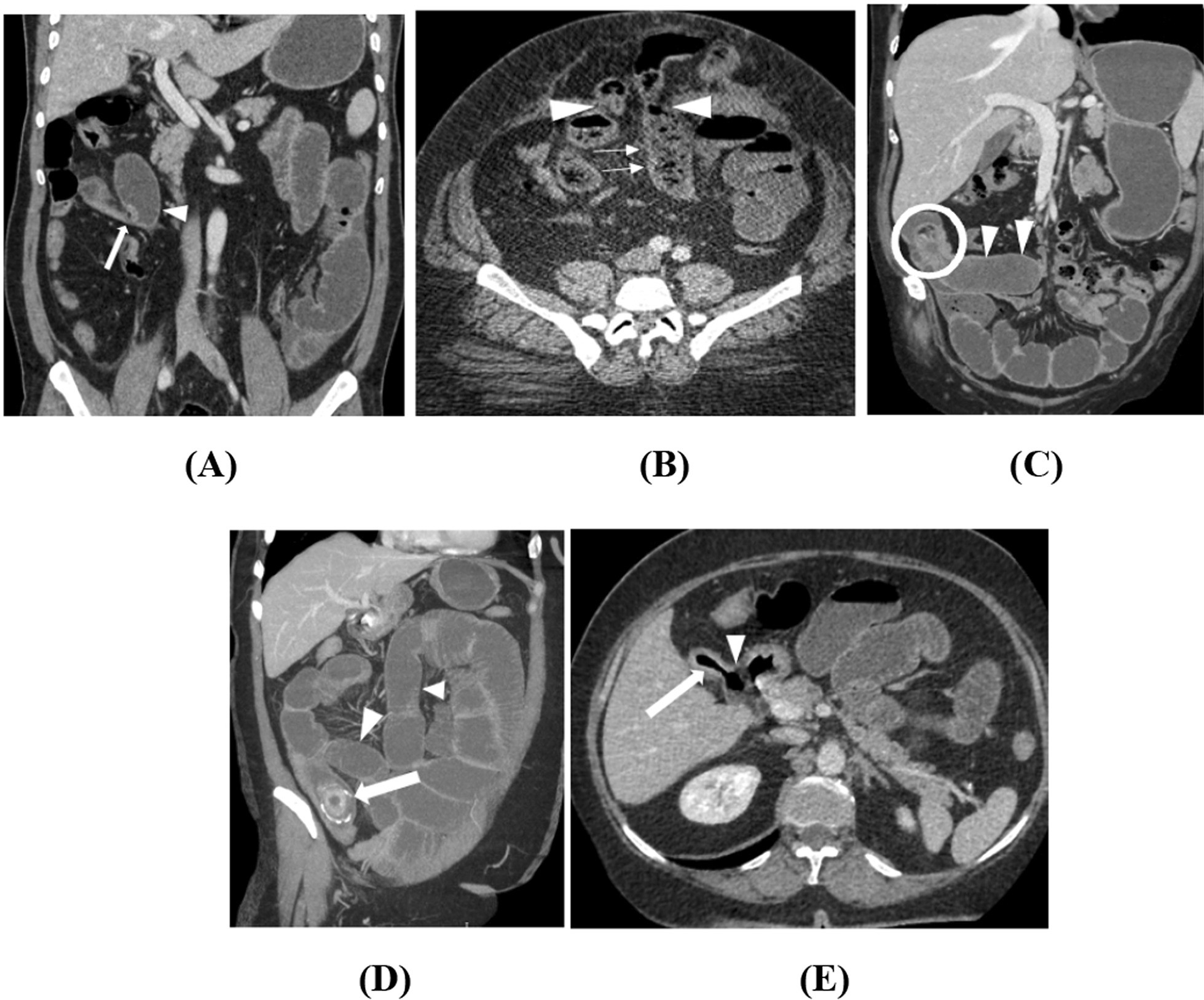 Fig. 4