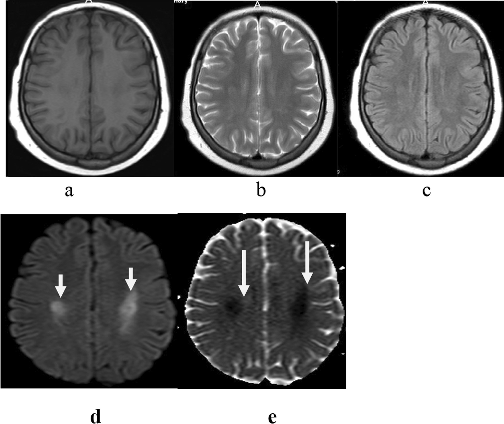 Fig. 7