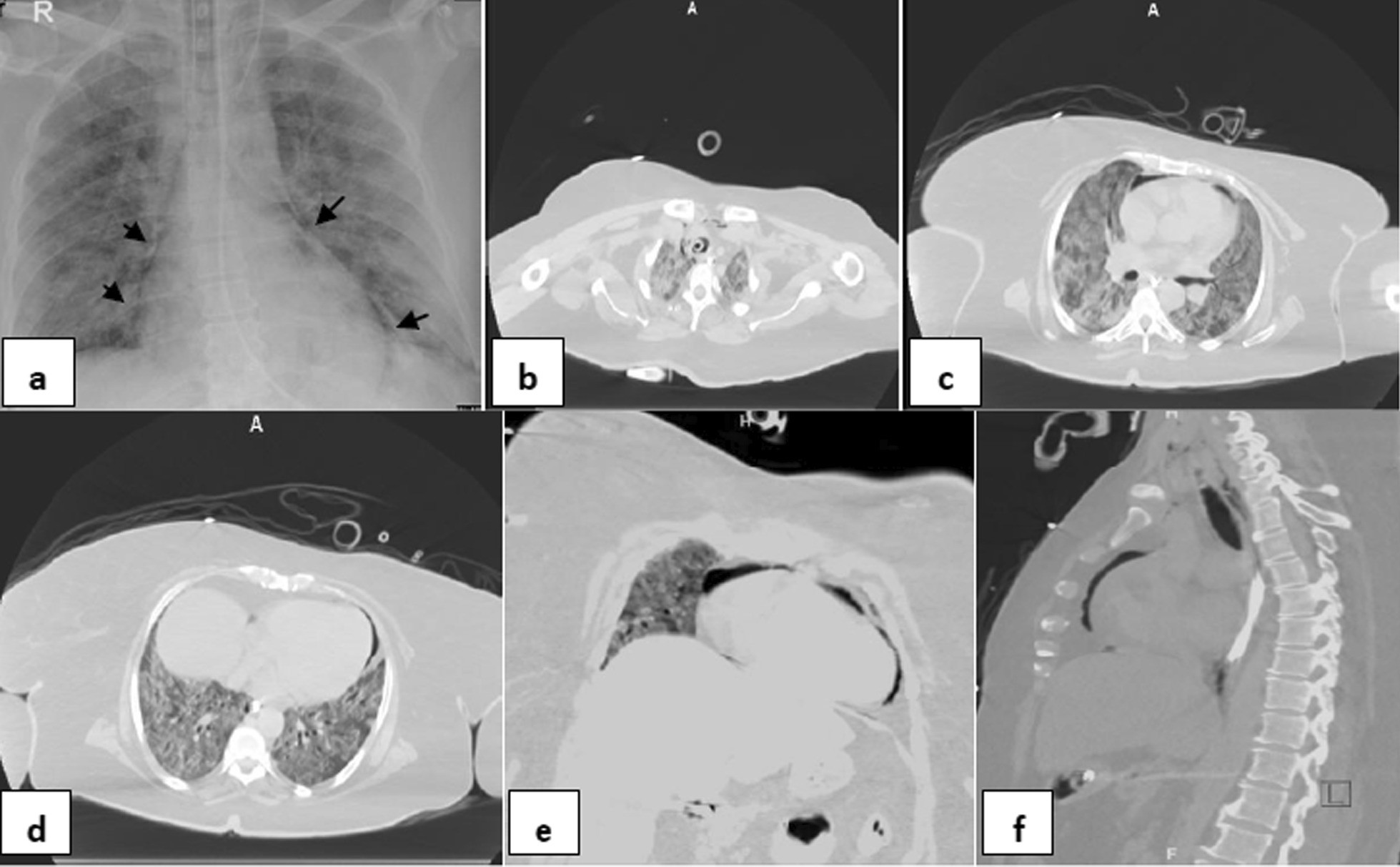 Fig. 2