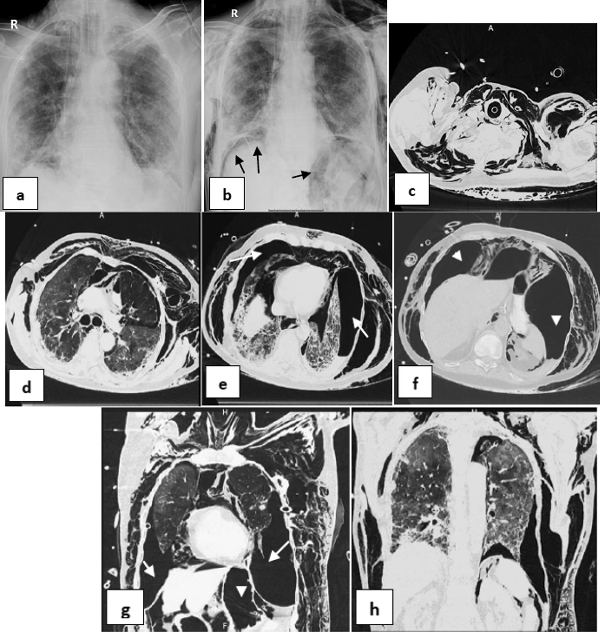 Fig. 7