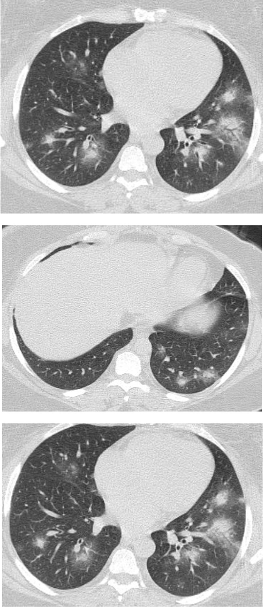 Fig. 16