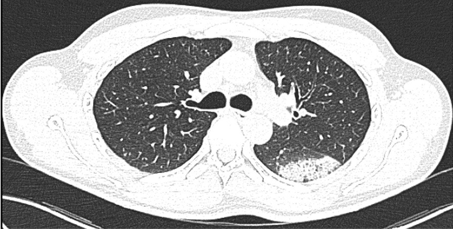 Fig. 3