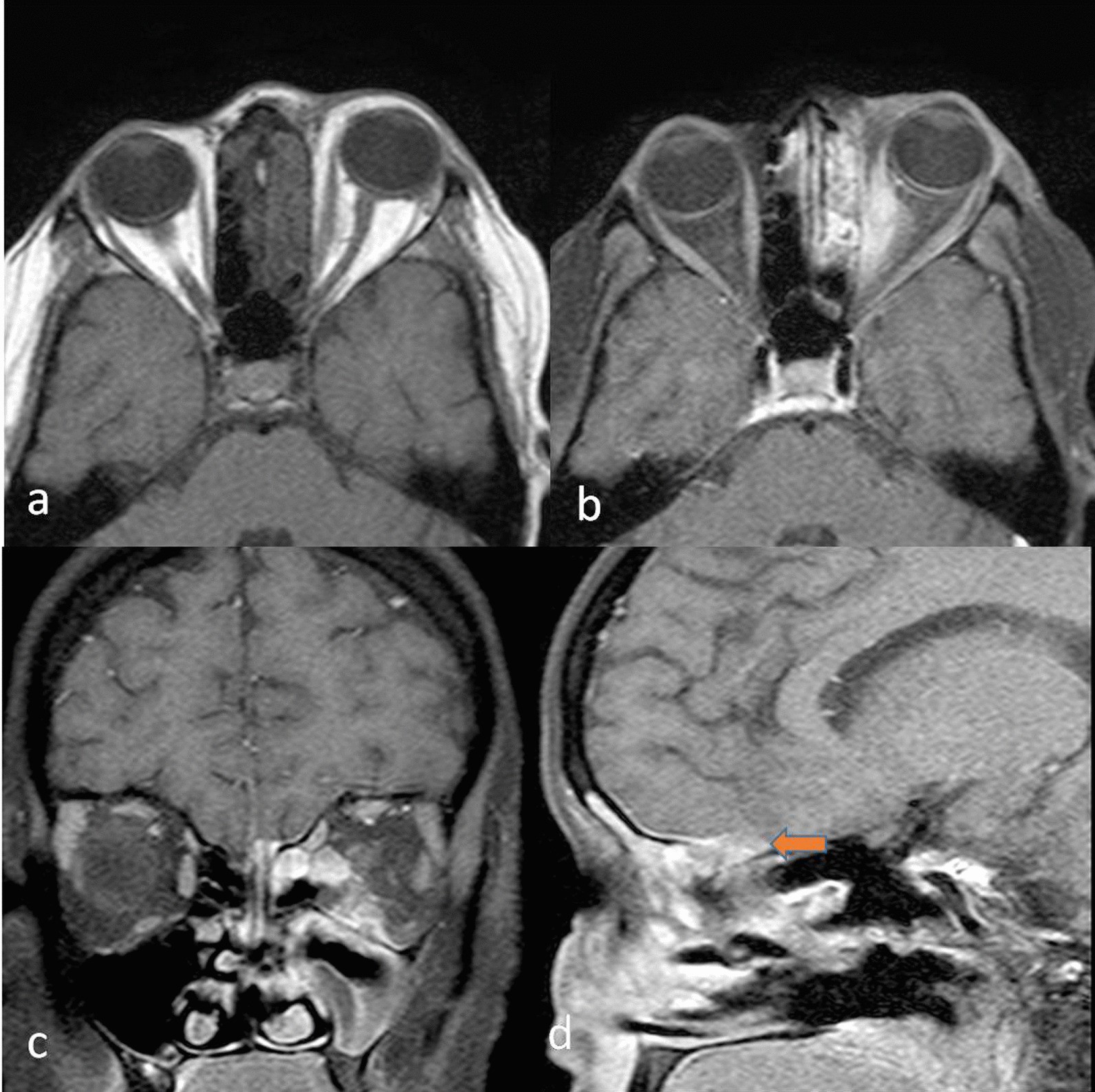 Fig. 10