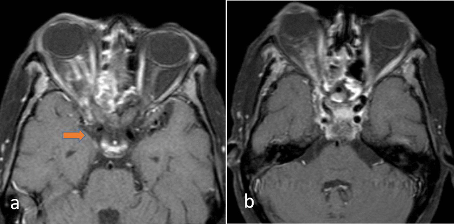 Fig. 7