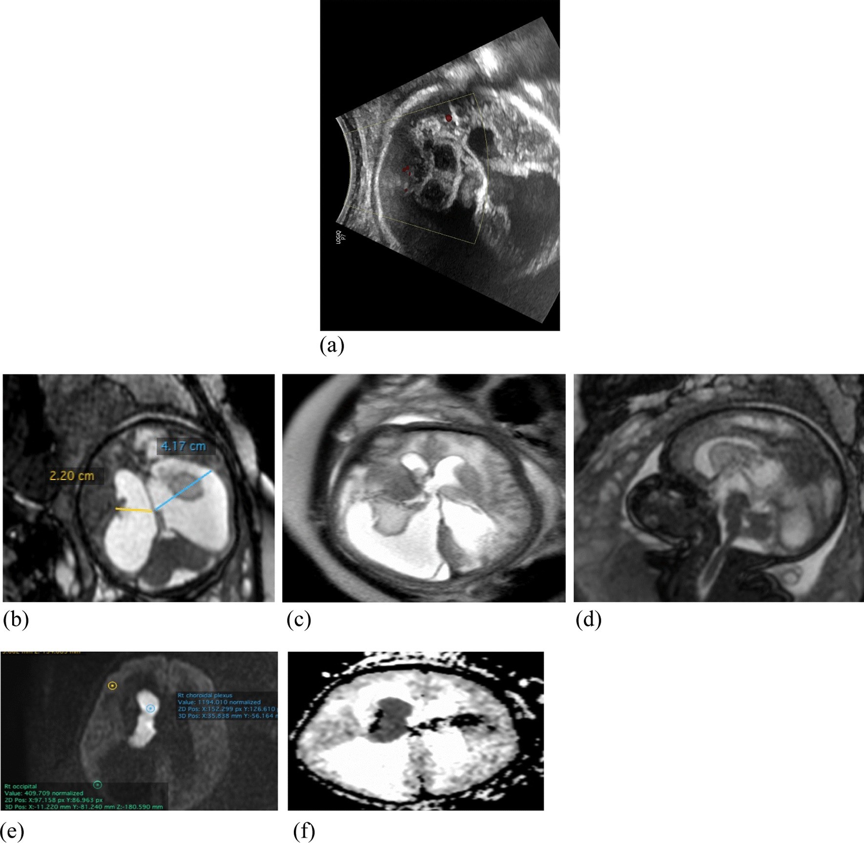 Fig. 4