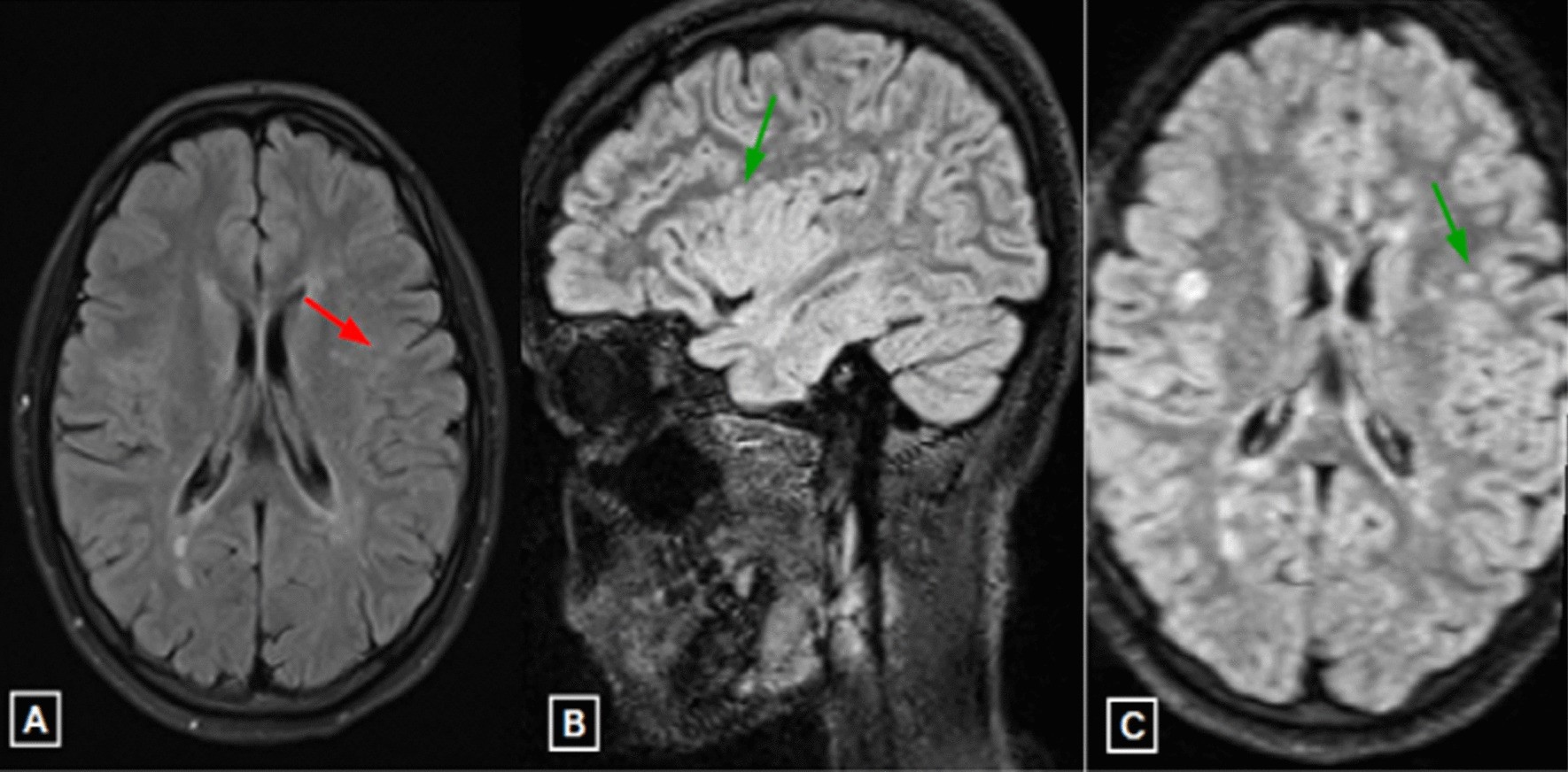 Fig. 5