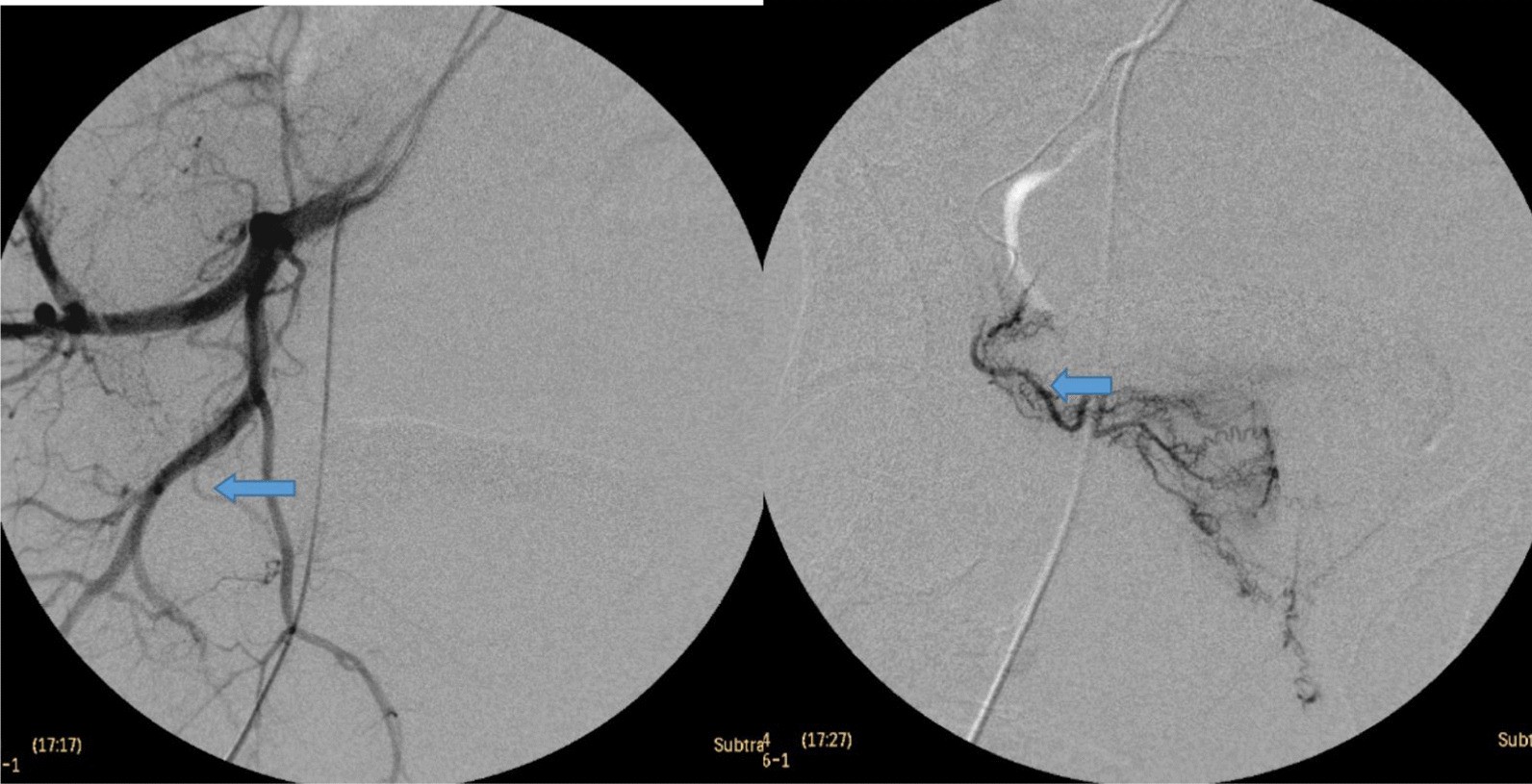 Fig. 14