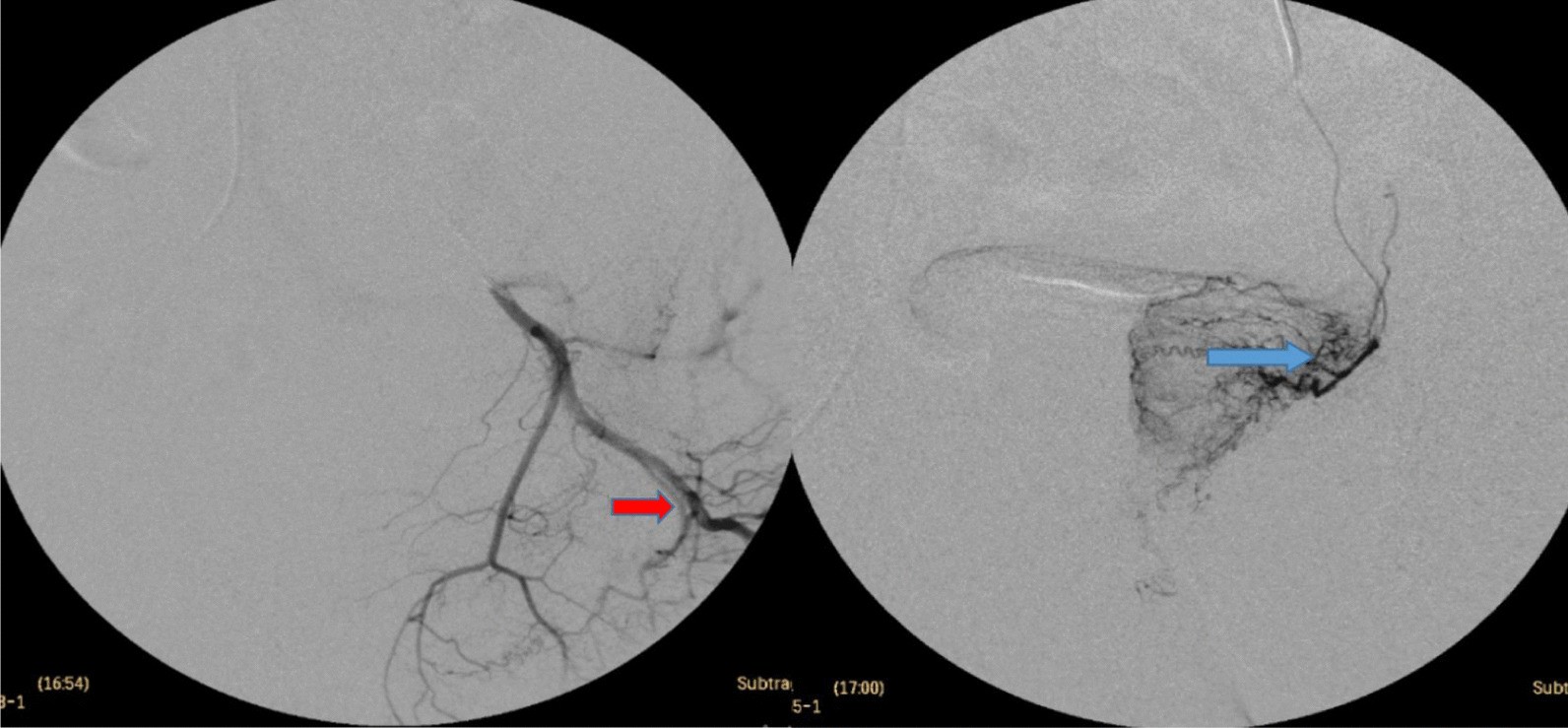 Fig. 15