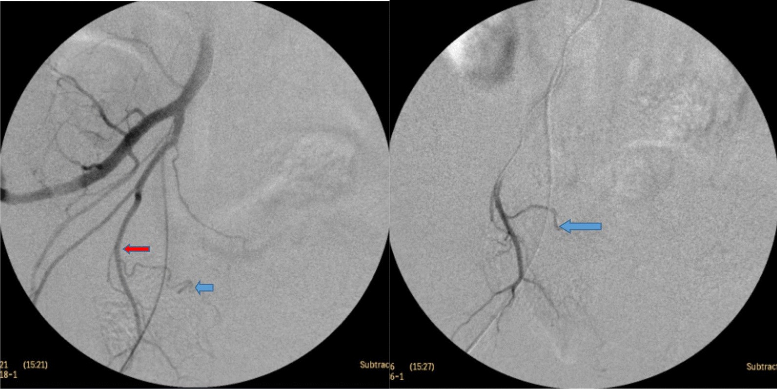 Fig. 4