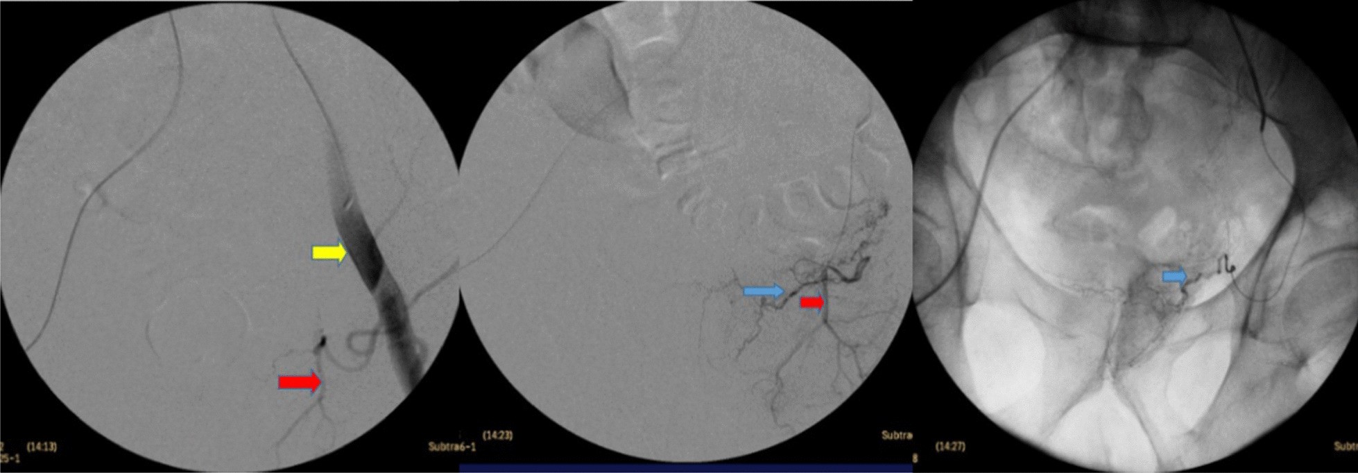 Fig. 9