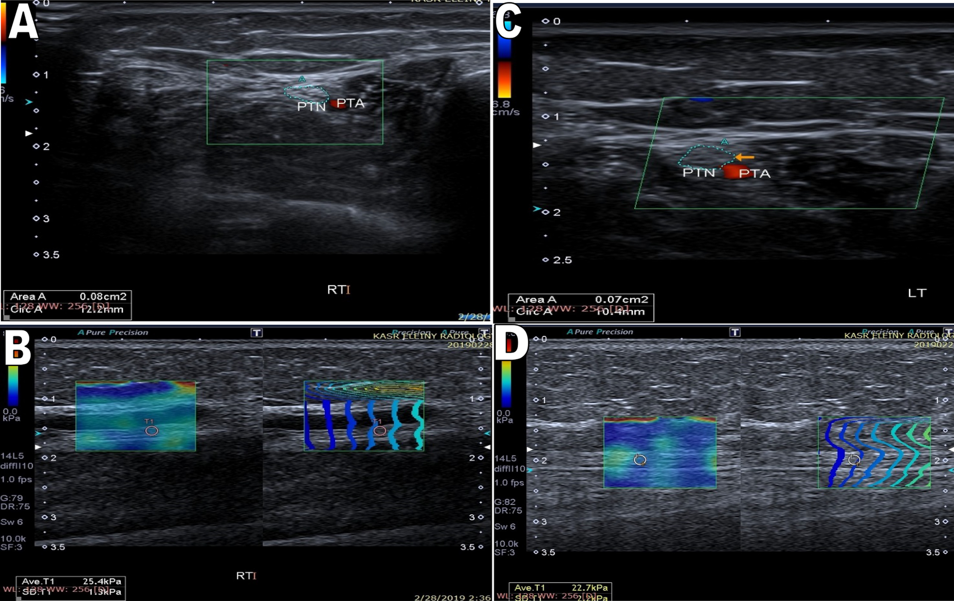 Fig. 4