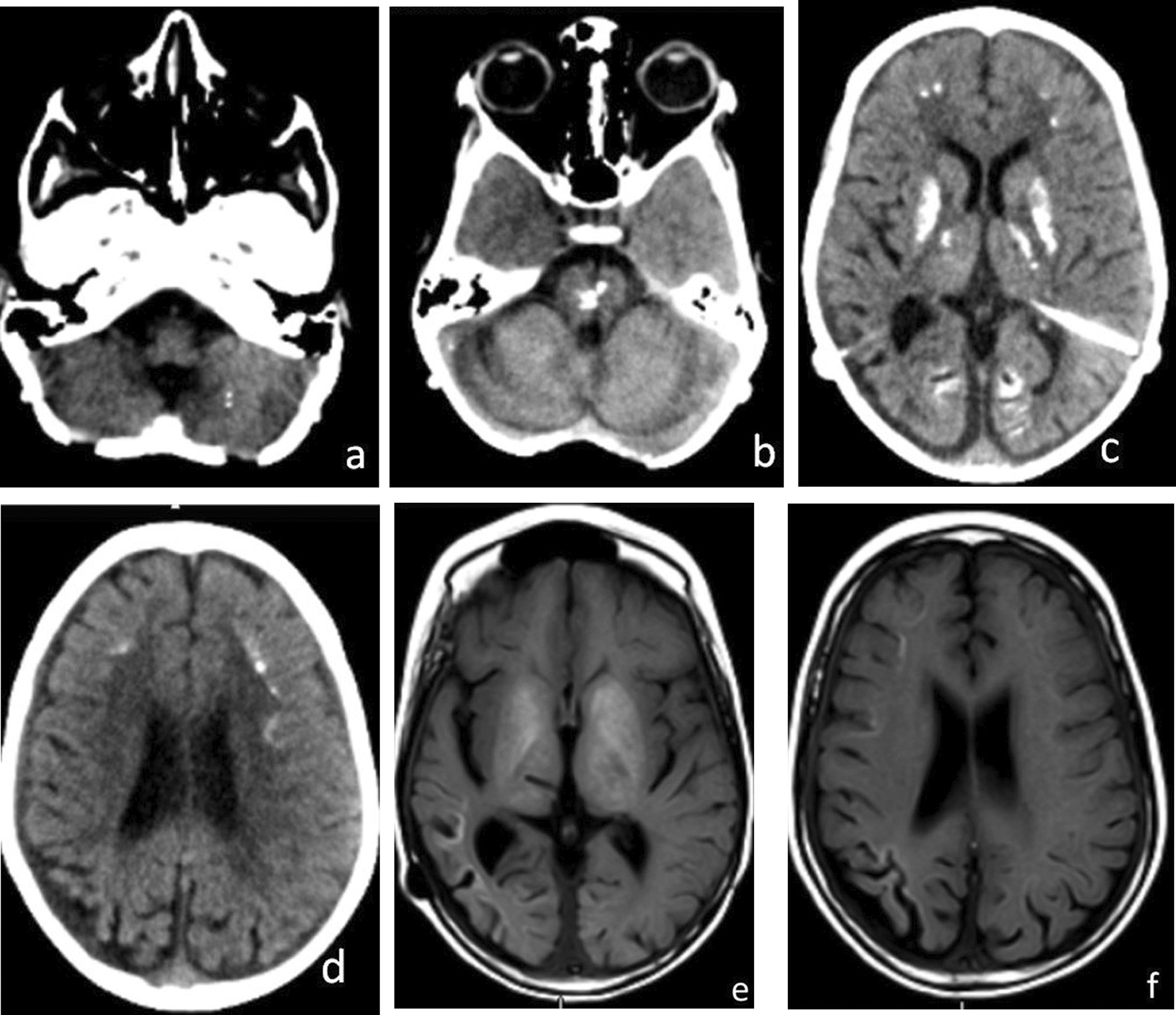 Fig. 2