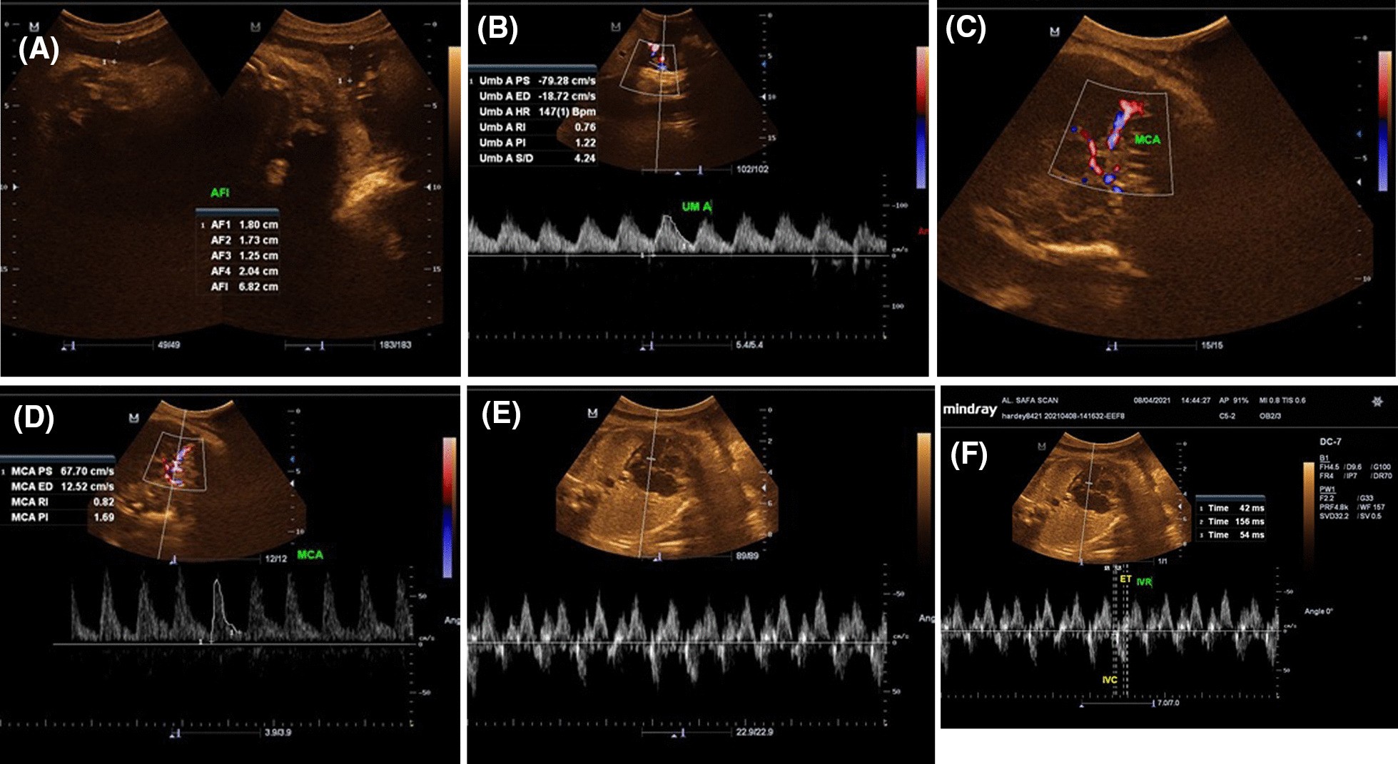 Fig. 6