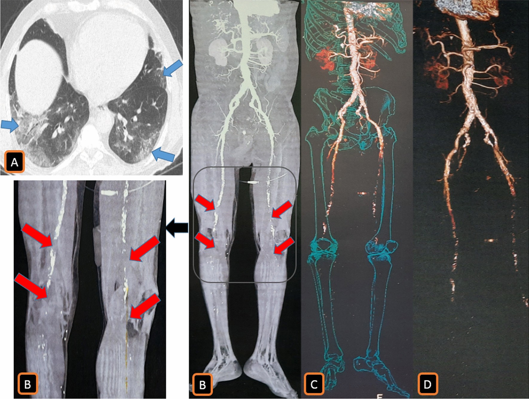 Fig. 15