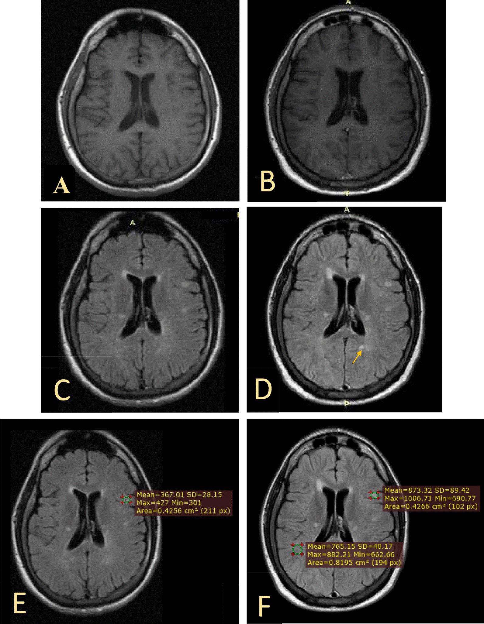 Fig. 4