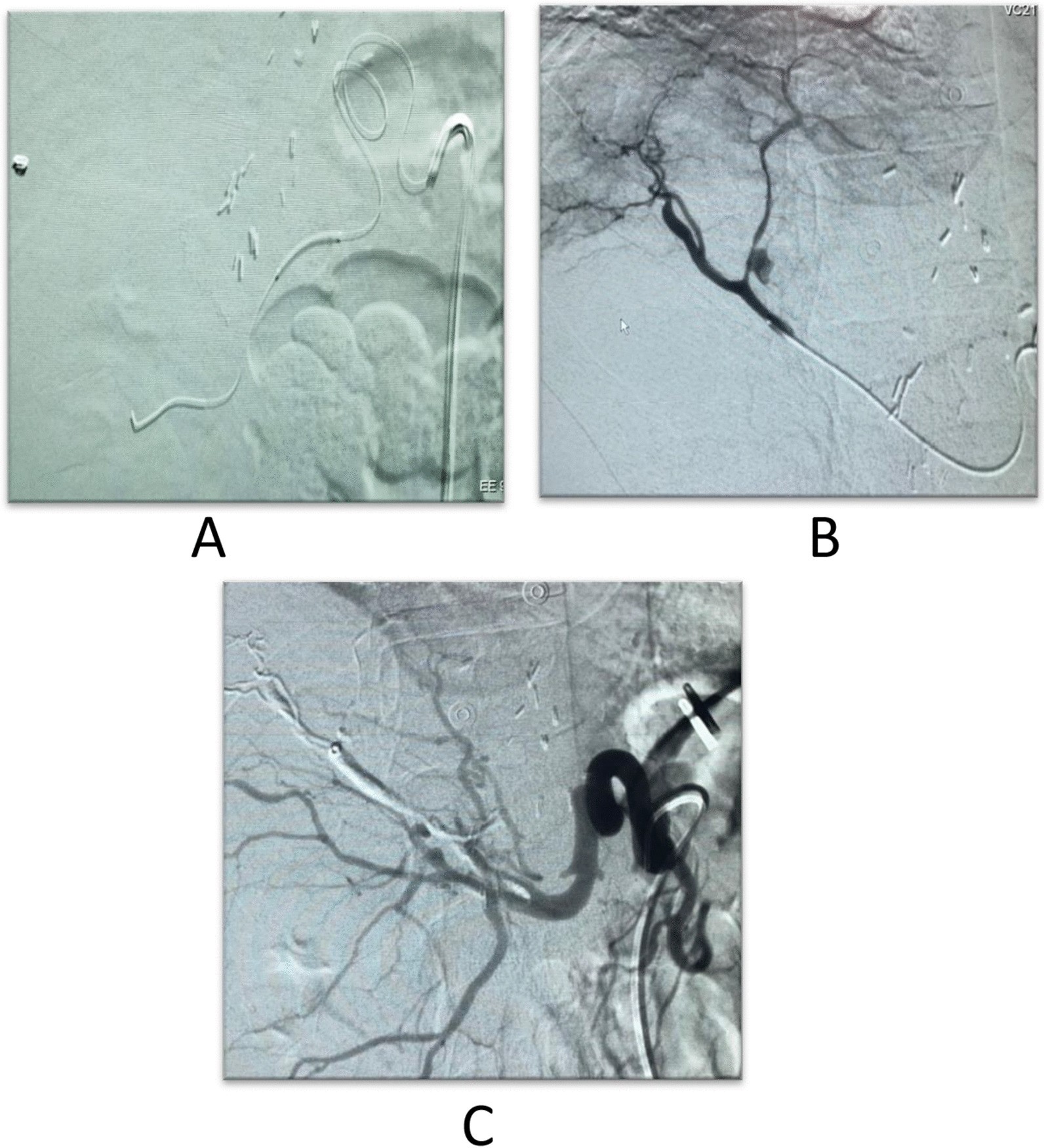 Fig. 10