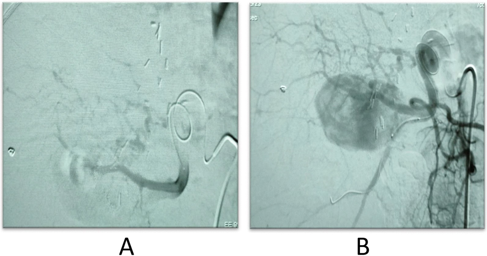 Fig. 11