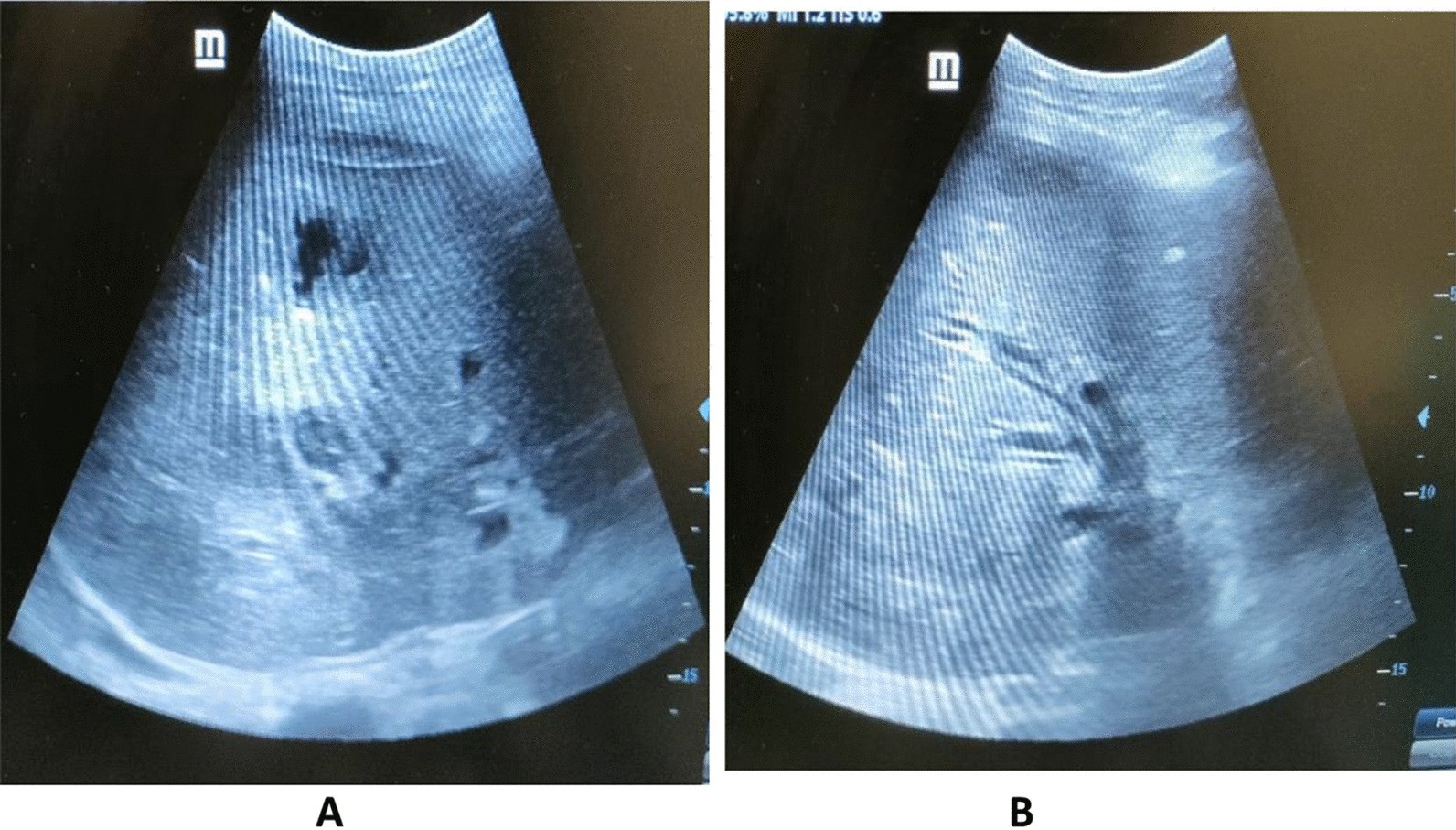 Fig. 17