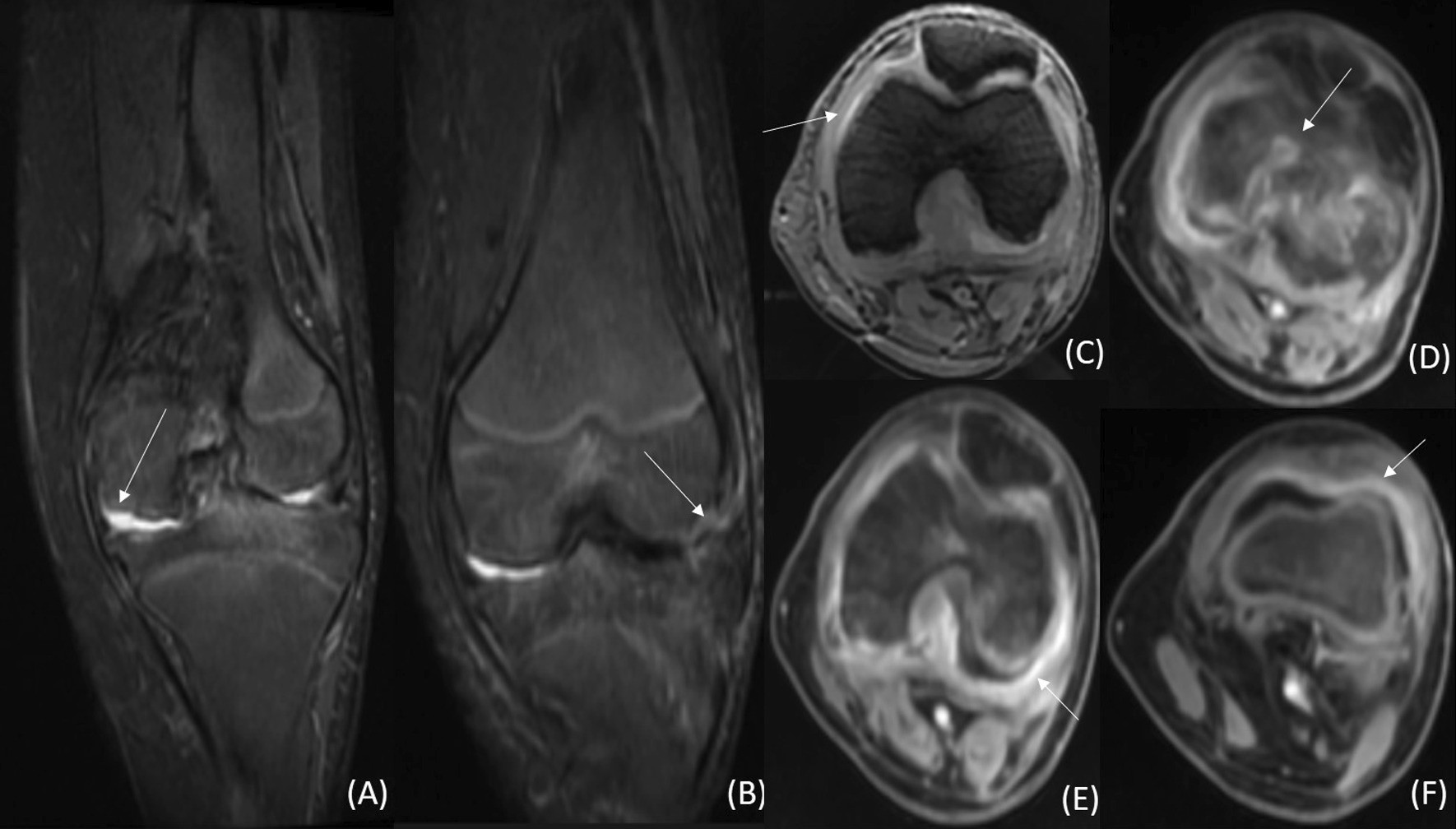 Fig. 11