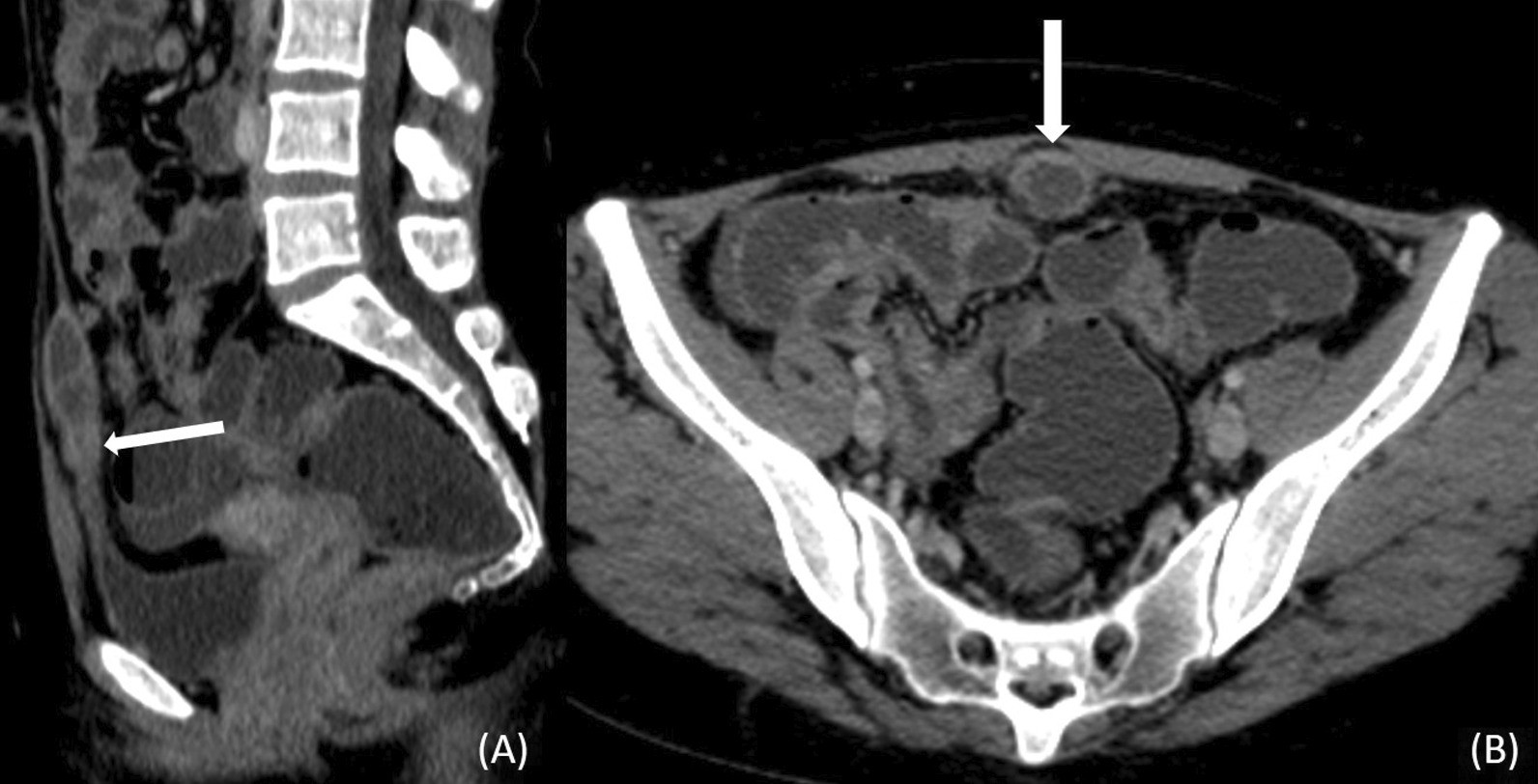 Fig. 12