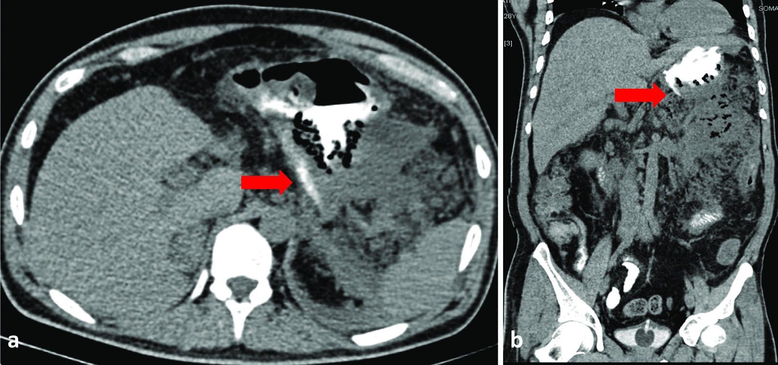 Fig. 2