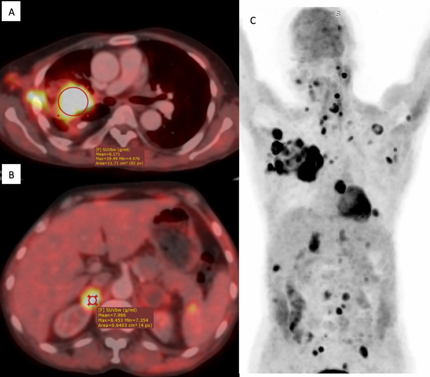 Fig. 1