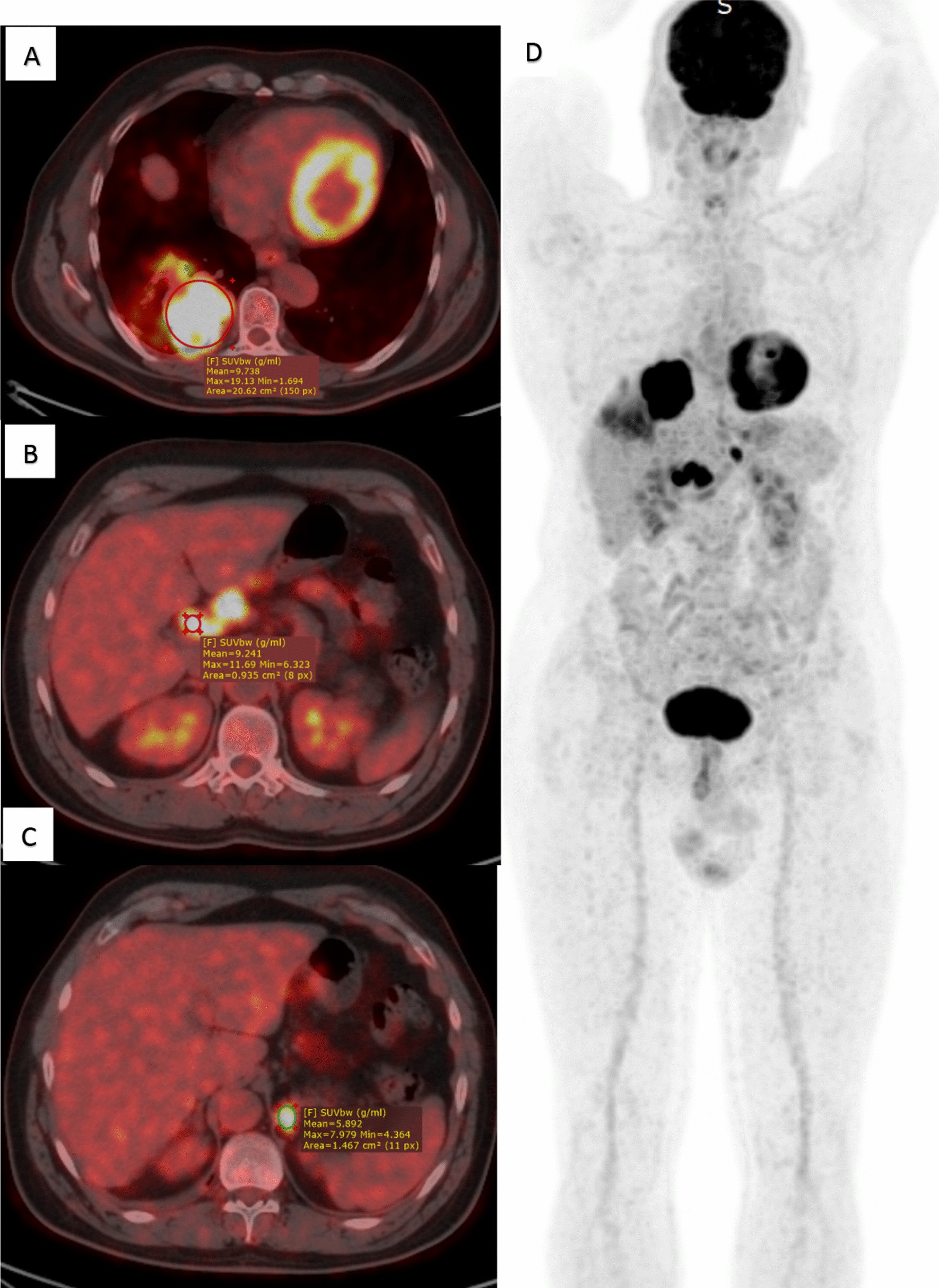 Fig. 2