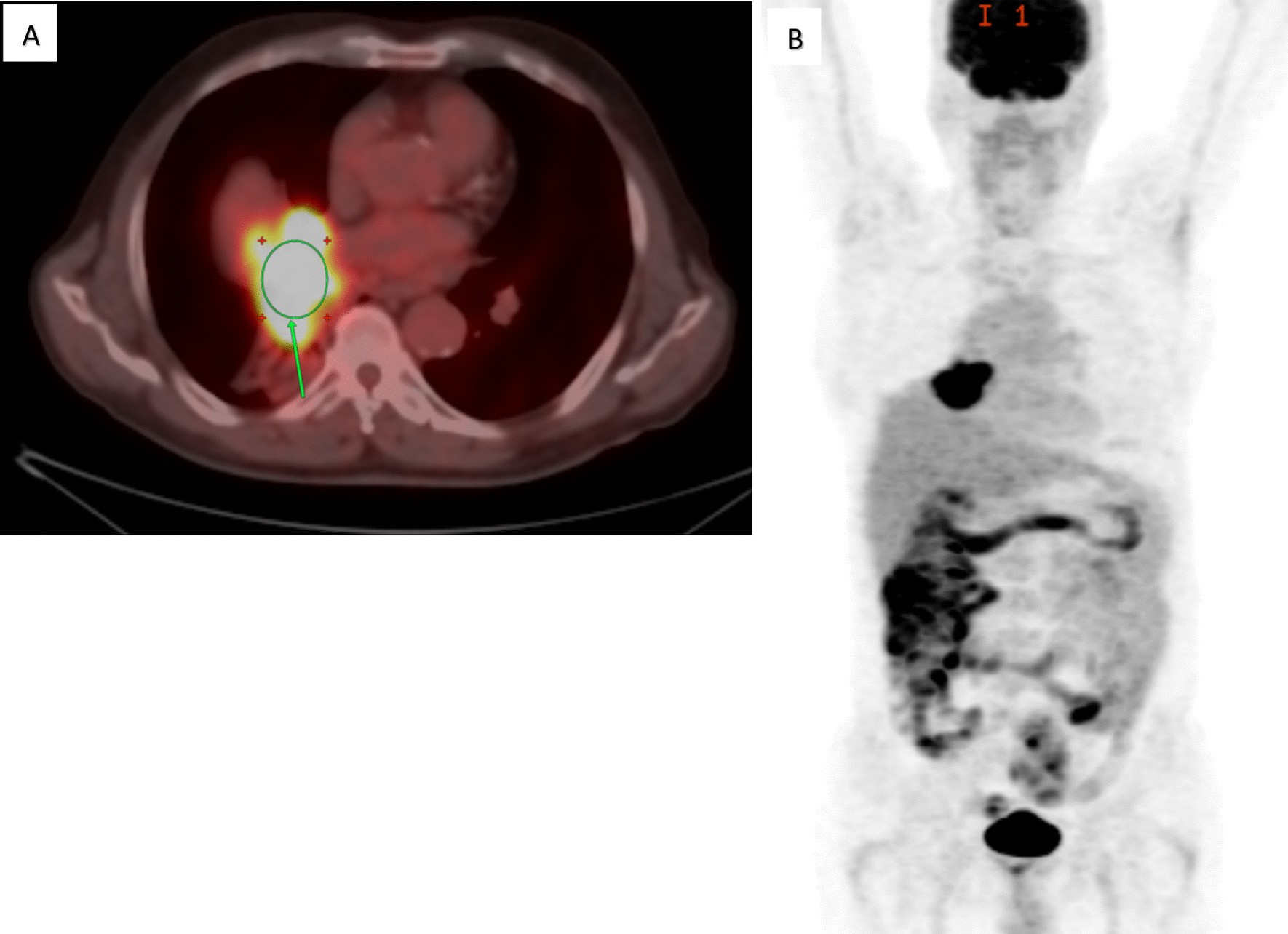 Fig. 4