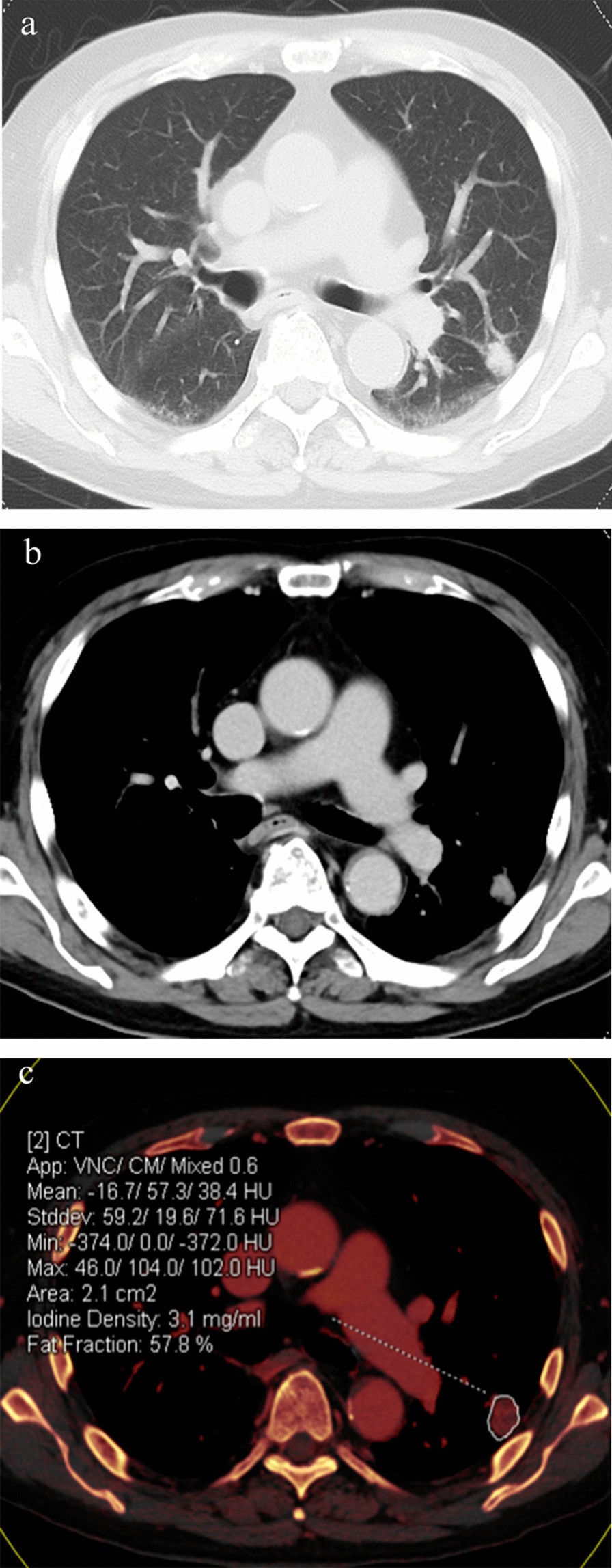 Fig. 2