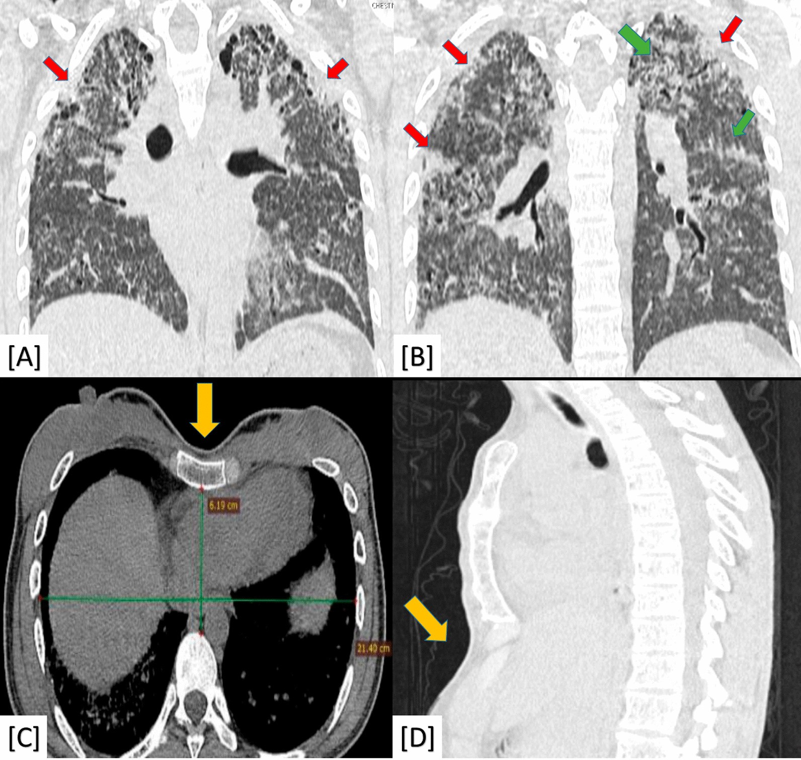 Fig. 4