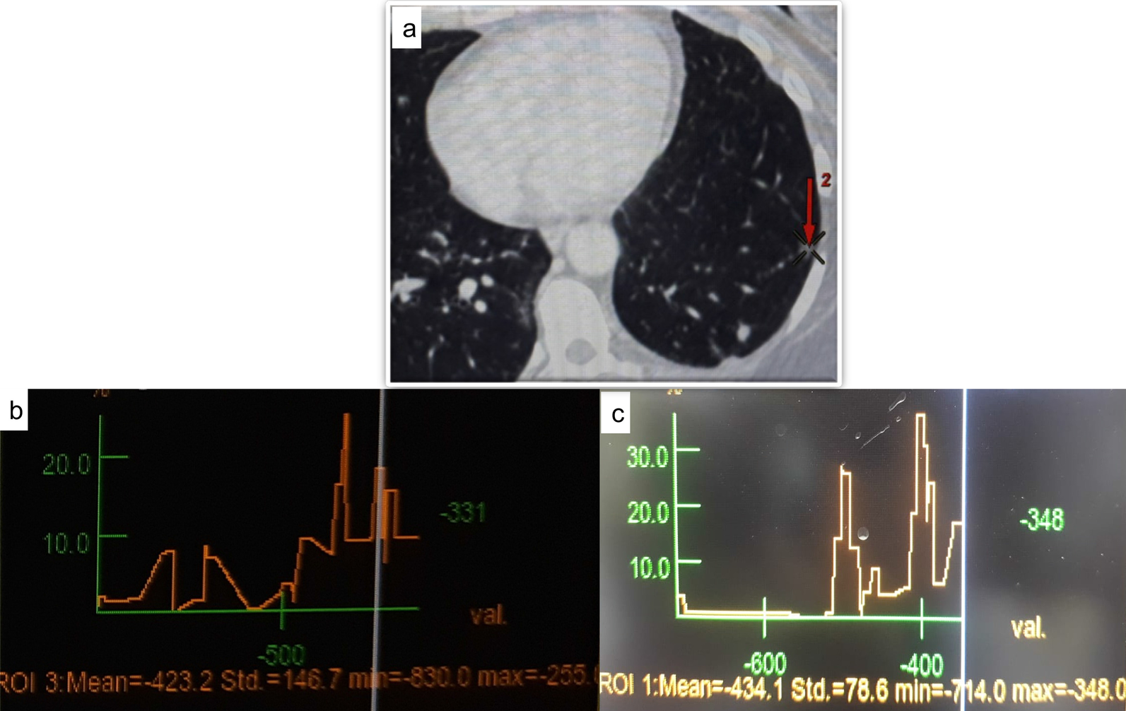 Fig. 3