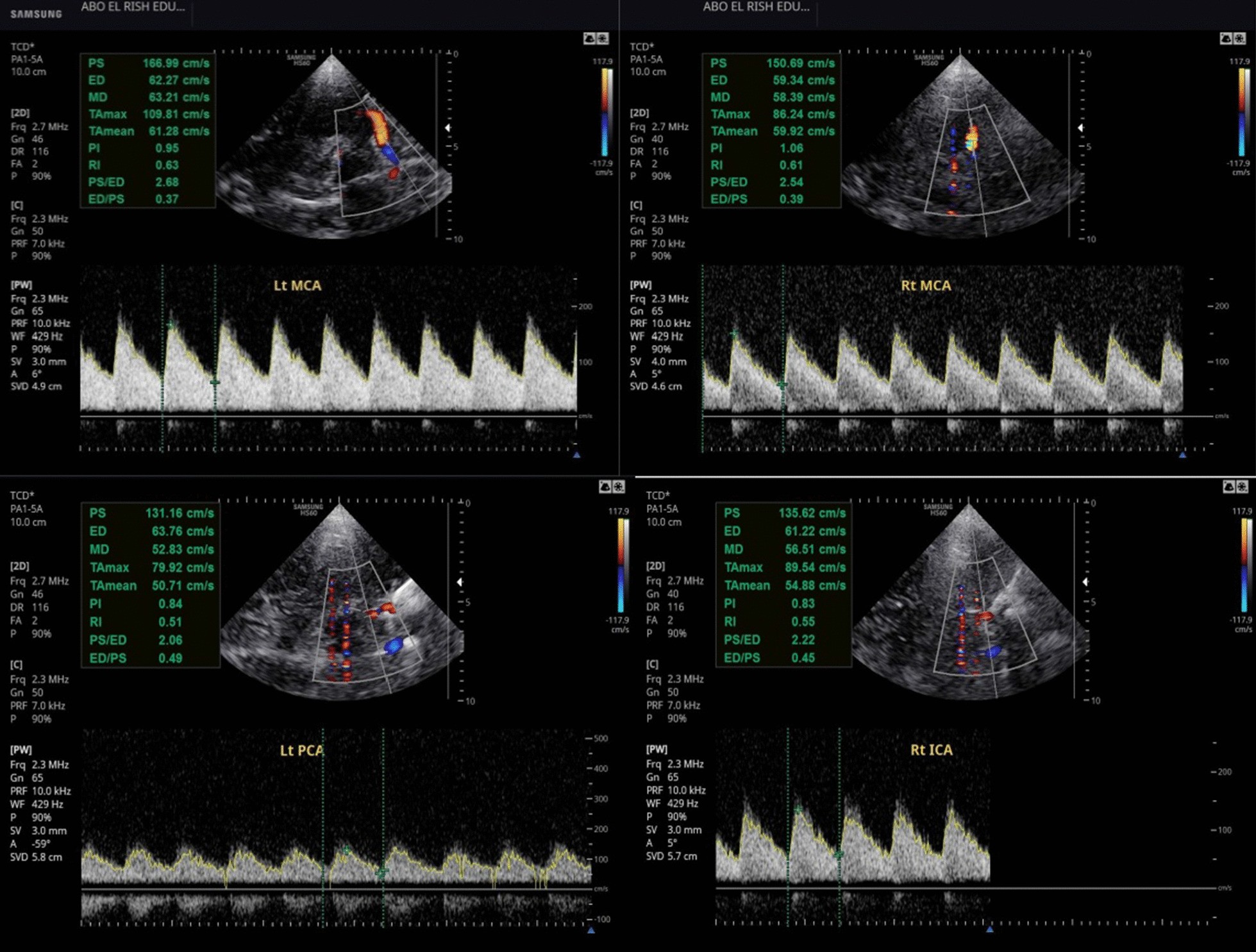 Fig. 2