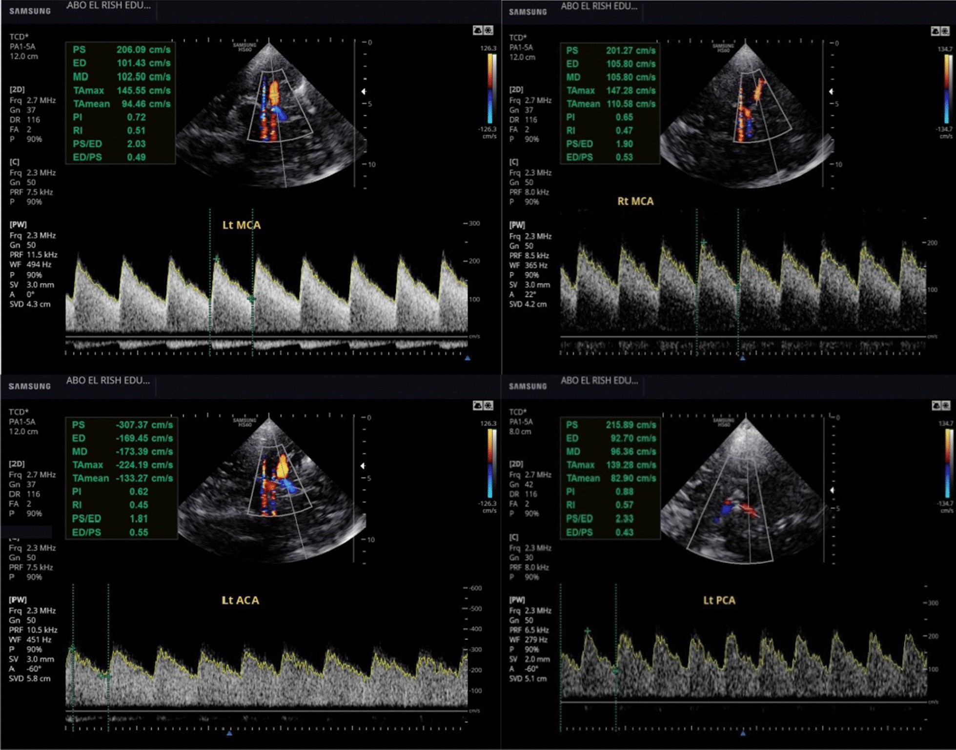 Fig. 3