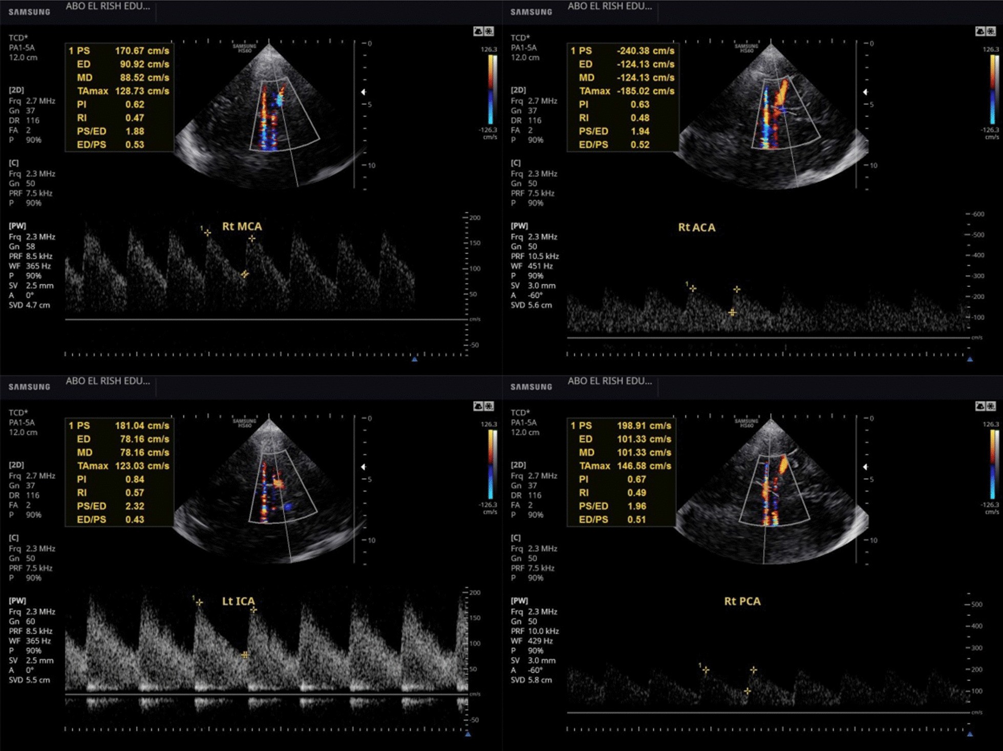 Fig. 4