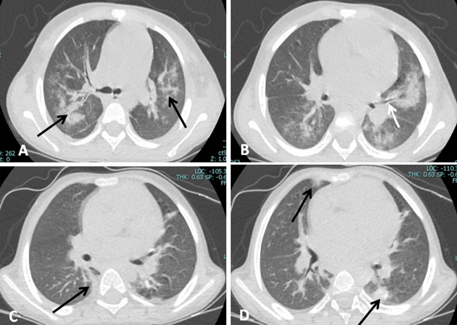 Fig. 10