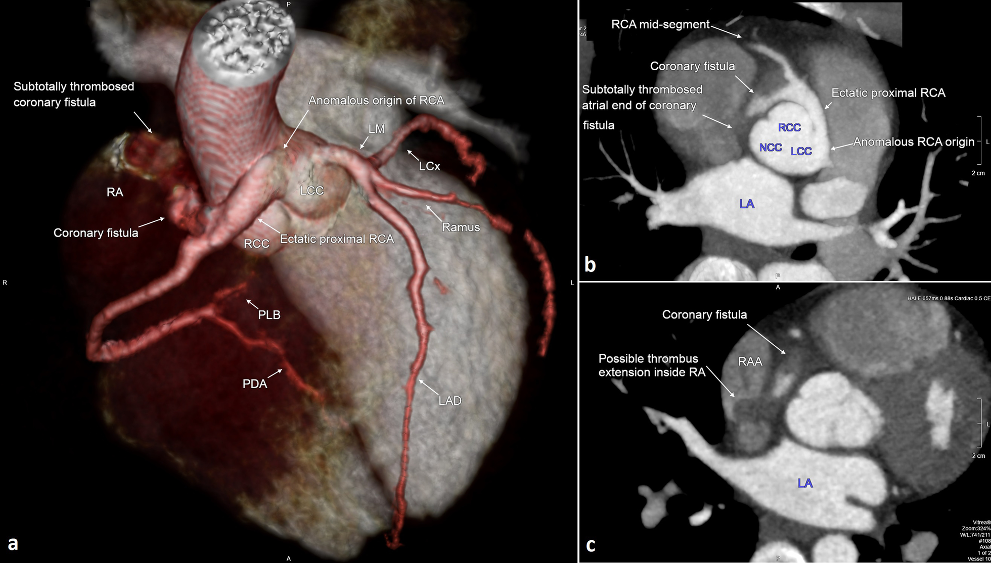 Fig. 4