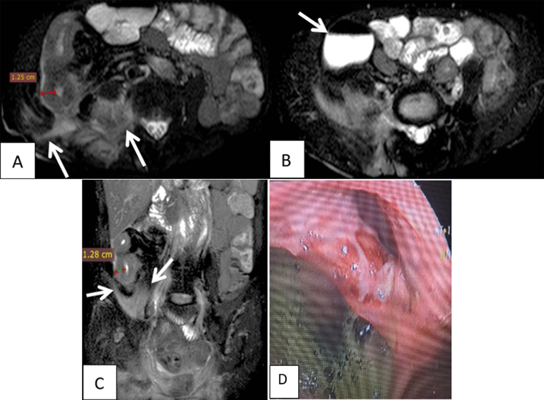 Fig. 10