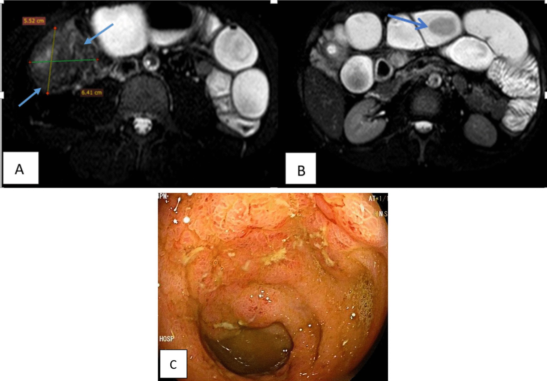 Fig. 4