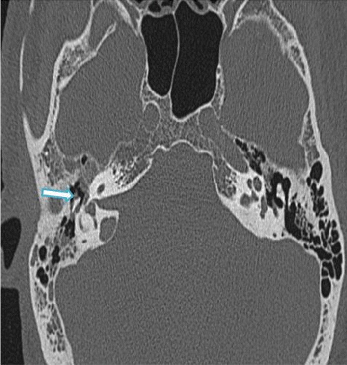 Fig. 11