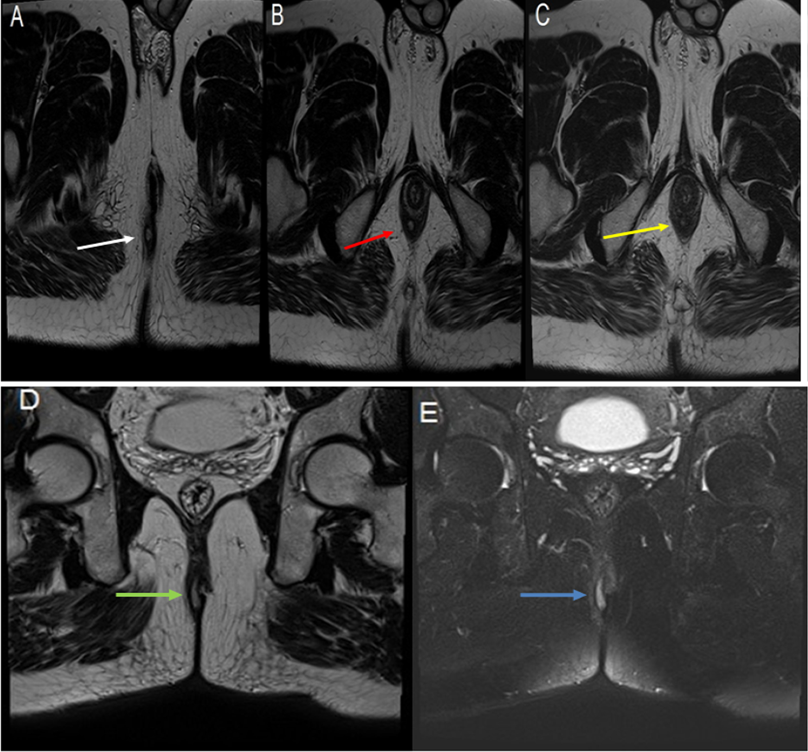 Fig. 4