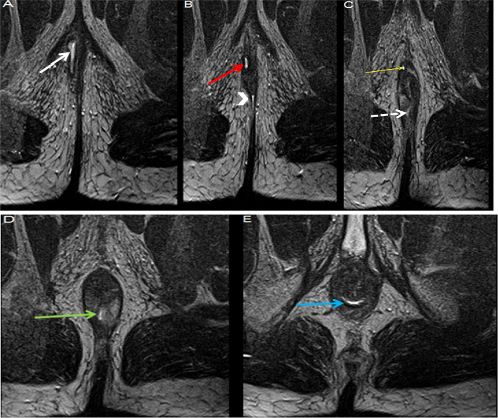 Fig. 5