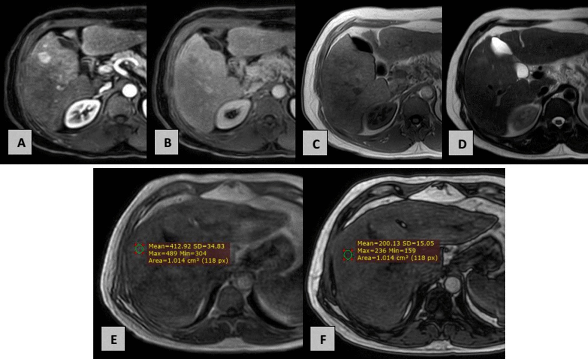 Fig. 5