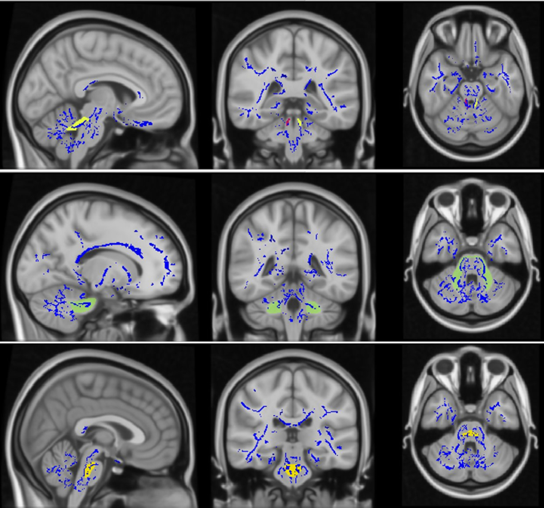 Fig. 11