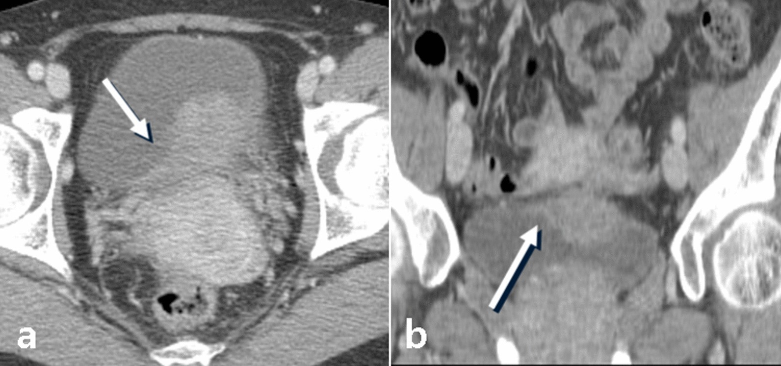 Fig. 10