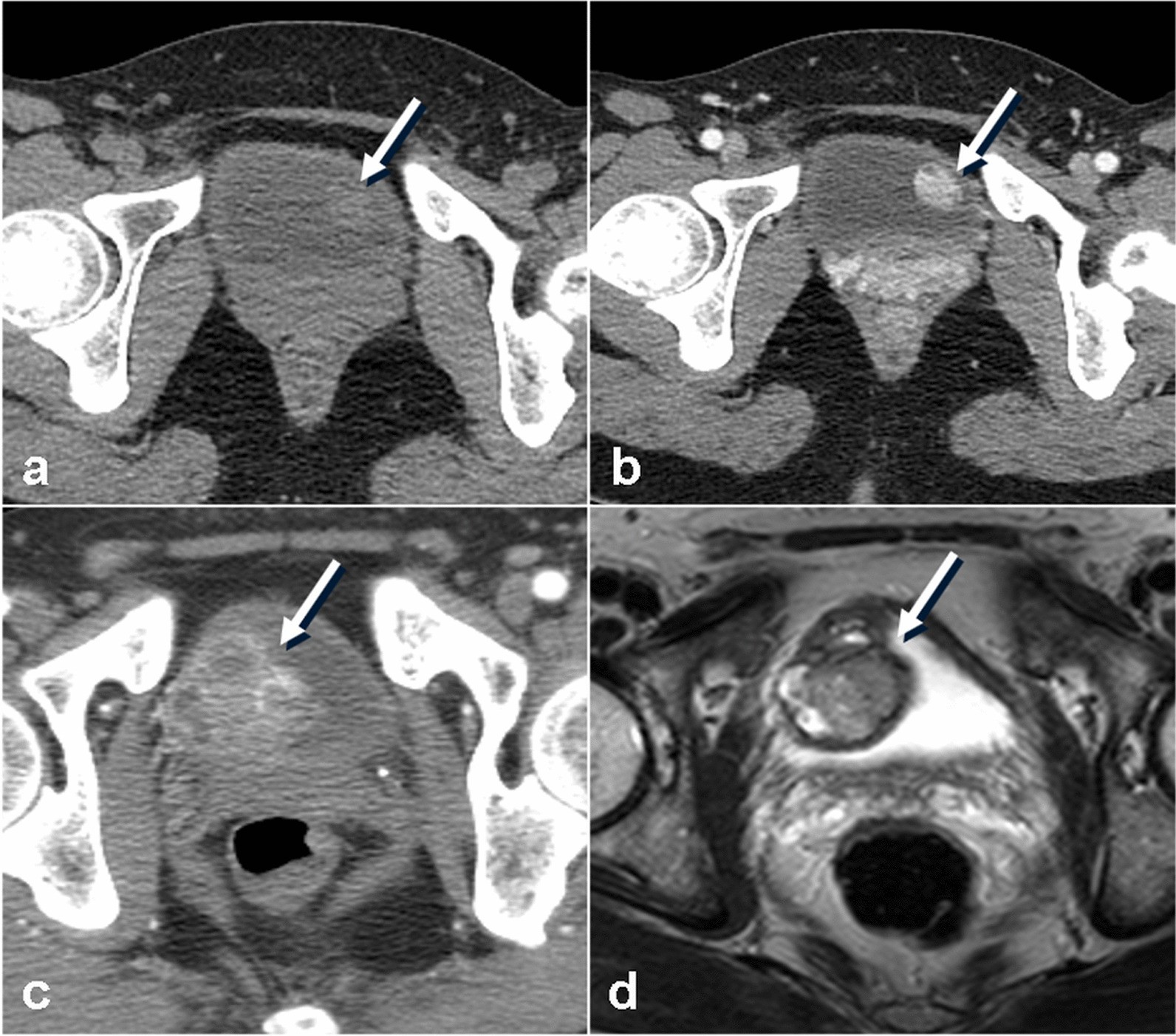 Fig. 11