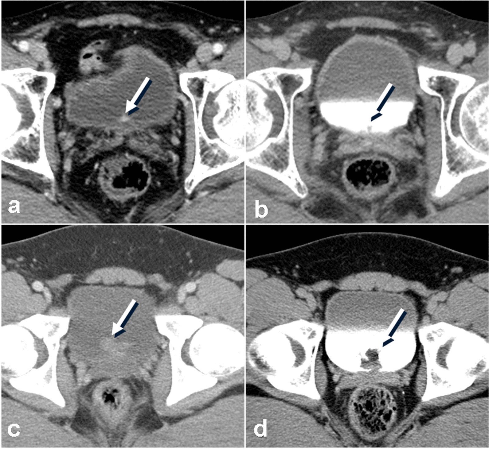 Fig. 8