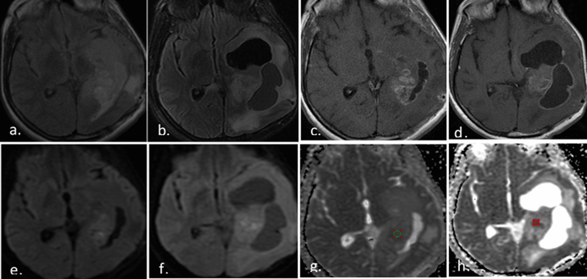 Fig. 5