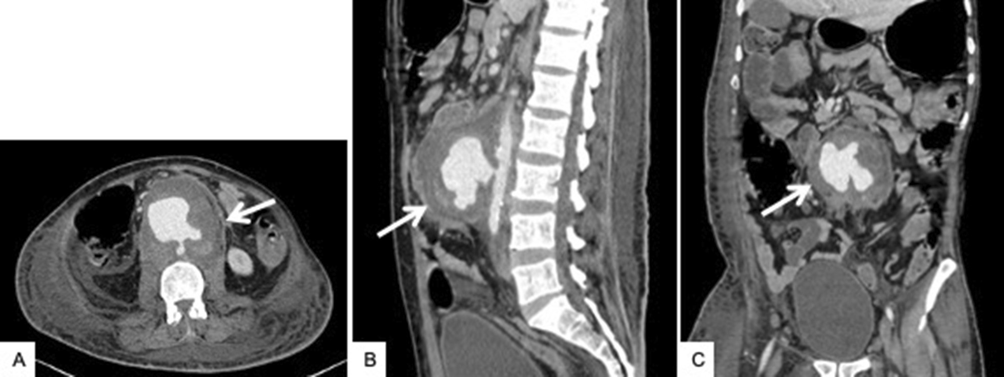 Fig. 11