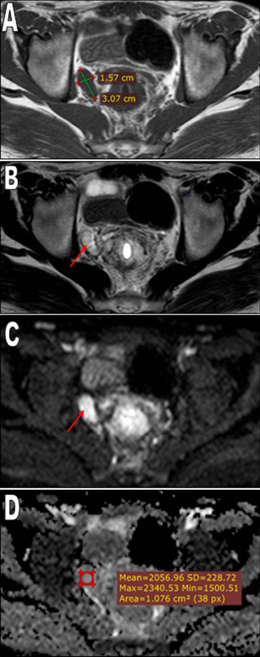 Fig. 4