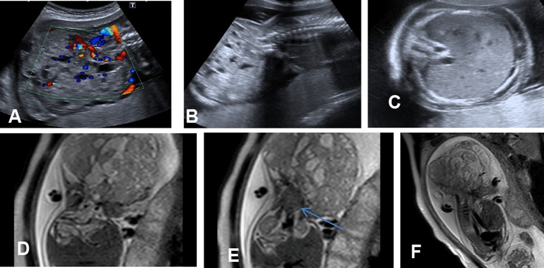 Fig. 5